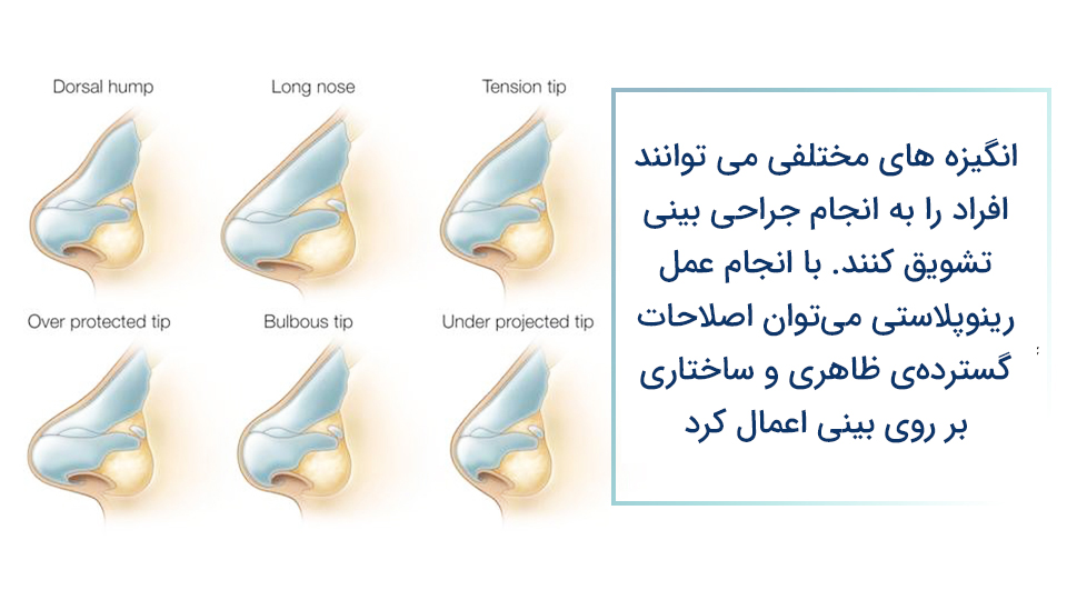 اهداف از جراحی بینی
