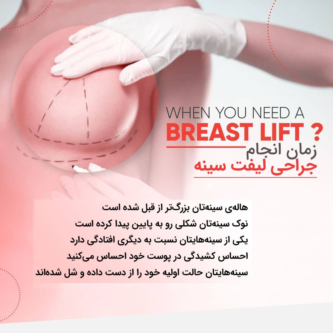 دلیل انجام ماستوپکسی