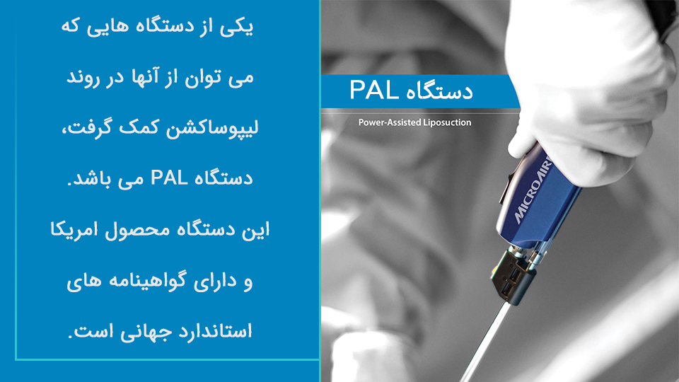 دستگاه پال
