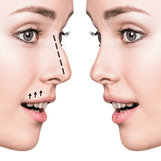 ایجاد تغییرات ساختاری