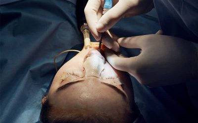 همه چیز در مورد جراحی بینی