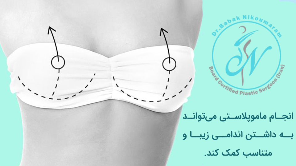 مزایای ماموپلاستی