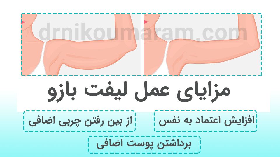 مزایا لیفت ابرو