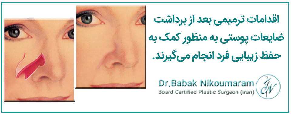 ترمیم سرطان پوست