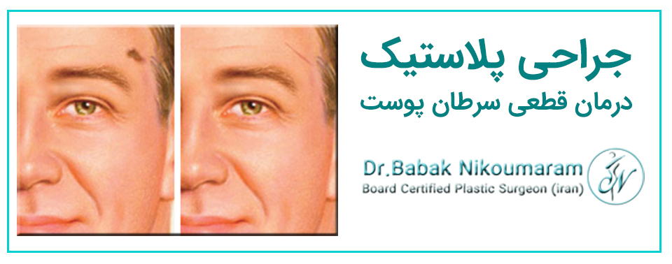 جراحی سرطان پوست