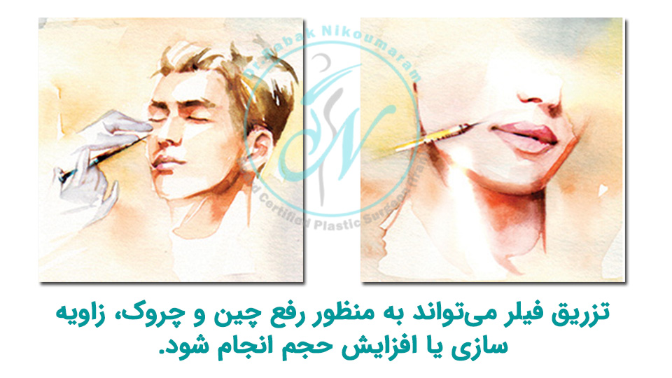 تزریق فیلر