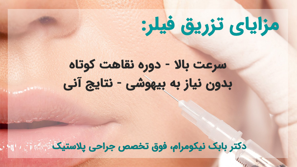 مزایای تزریق فیلر
