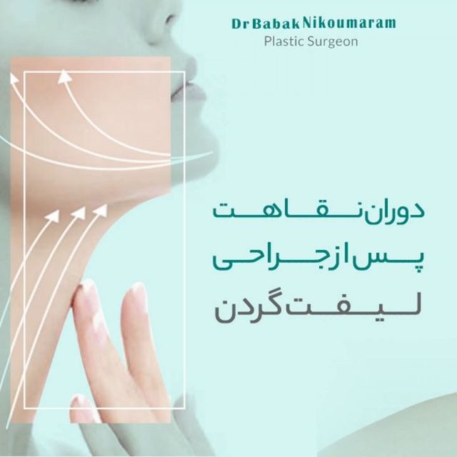 نقاهت عمل لیفت گردن