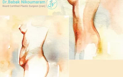 ضروری ترین مراقبتها بعد از ابدومینوپلاستی