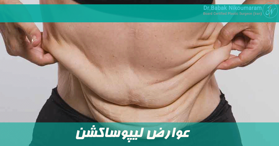 عوارض لیپوساکشن 
