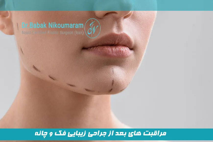 مراقبت های بعد از جراحی زیبایی فک و چانه