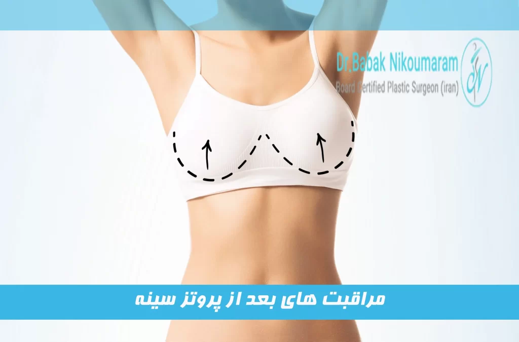 مراقبت های بعد از پروتز سینه