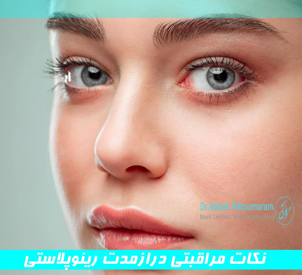 نکات مراقبتی درازمدت رینوپلاستی
